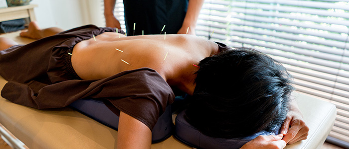 a patient receiving acupuncture treatment